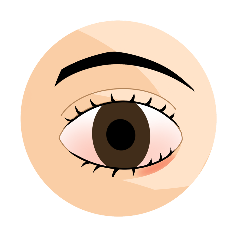 ecd_distichiasis_know