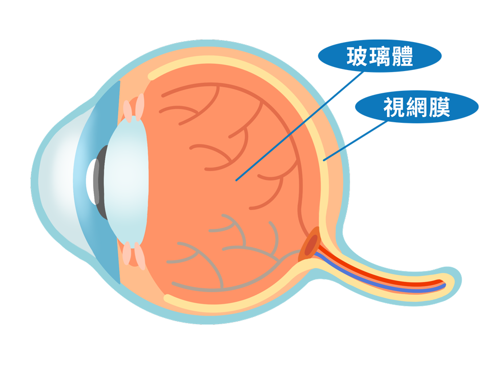 ecd_floaters_type