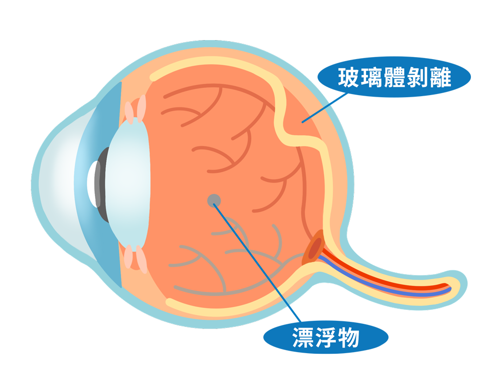 ecd_floaters_type